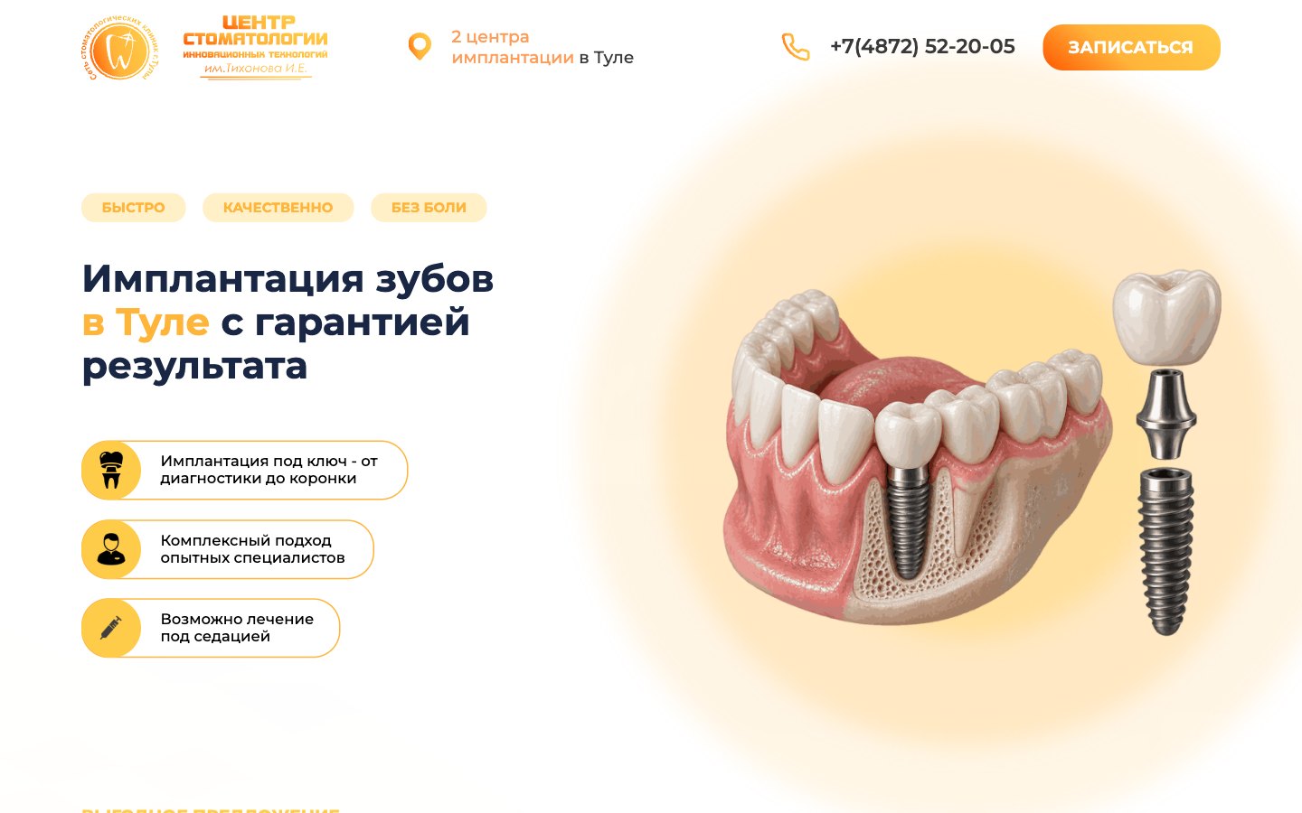 Главный экран страницы об имплантации зубов в Туле